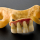 Dentadura inferior con dientes humanos, Inglaterra, 1800-1870.